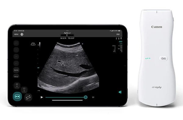 当院が導入しているエコー(超音波画像診断機)本体とワイヤレスプローブ